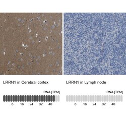 LRRN1/NLRR-1 Antibody, Novus Biologicals 0.1mL; Unlabeled:Antibodies, Polyclonal